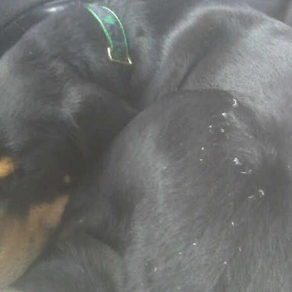 Before - White, flakey dandruff