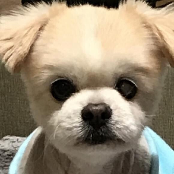 Lost vision in left eye but right eye is healthy; off pain meds, normal weight.